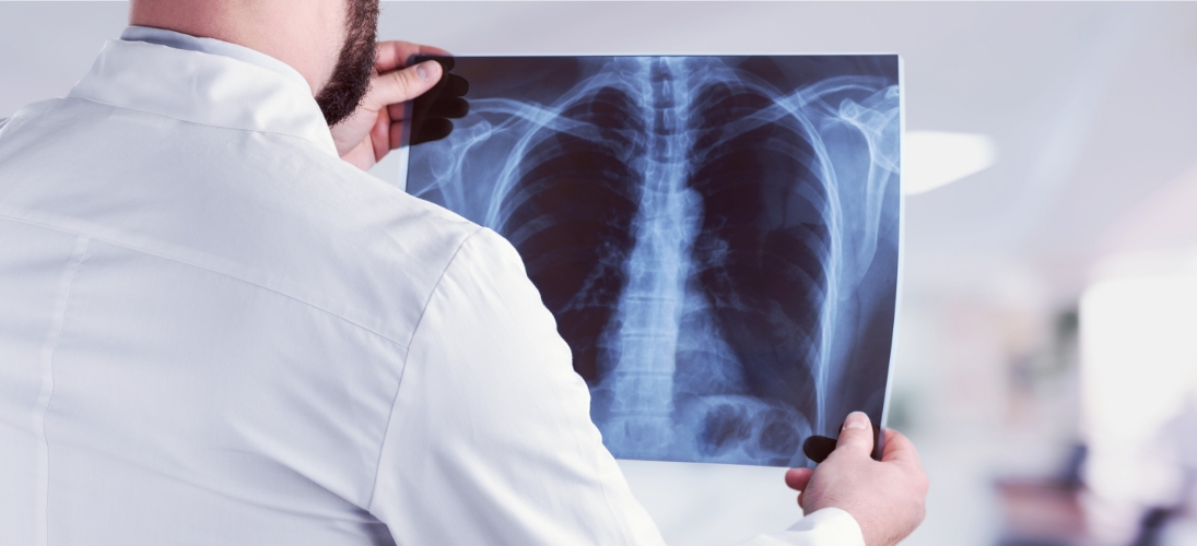 Pour lutter contre infections respiratoires aiguës (grippe, Covid-19, bronchiolite), la vaccination et les gestes barrières sont importants.